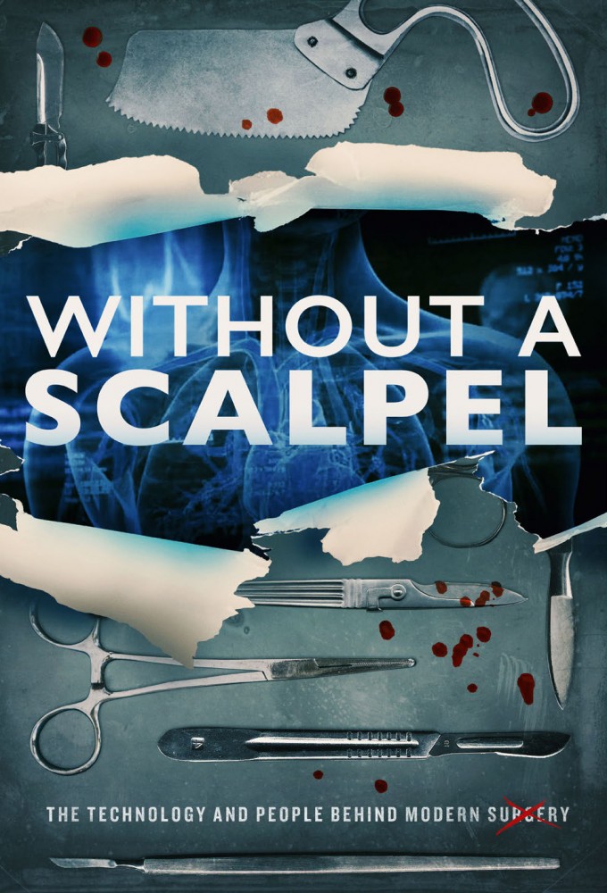 Without a Scalpel on FREECABLE TV